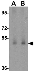 Anti-MFSD1 antibody used in Western Blot (WB). GTX85148