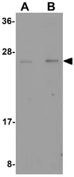 Anti-PLAC4 antibody used in Western Blot (WB). GTX85149