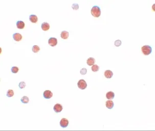 Anti-PLAC4 antibody used in Immunocytochemistry/ Immunofluorescence (ICC/IF). GTX85149