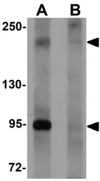 Anti-Pappalysin 2 antibody used in Western Blot (WB). GTX85150