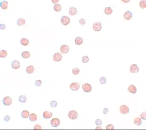 Anti-Pappalysin 2 antibody used in Immunocytochemistry/ Immunofluorescence (ICC/IF). GTX85150
