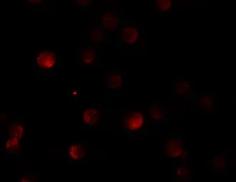 Anti-Pappalysin 2 antibody used in Immunocytochemistry/ Immunofluorescence (ICC/IF). GTX85150