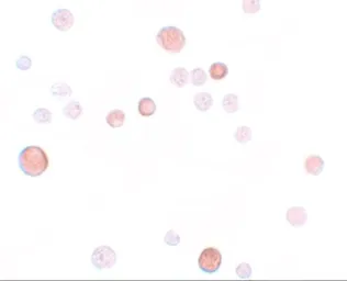 Anti-PLAC1 antibody used in Immunocytochemistry/ Immunofluorescence (ICC/IF). GTX85151