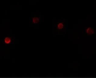 Anti-PLAC1 antibody used in Immunocytochemistry/ Immunofluorescence (ICC/IF). GTX85151