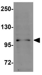 Anti-NALP11 antibody used in Western Blot (WB). GTX85153