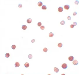 Anti-NALP11 antibody used in Immunocytochemistry/ Immunofluorescence (ICC/IF). GTX85153