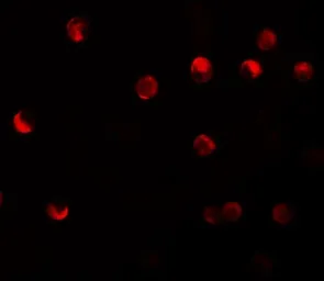 Anti-NALP11 antibody used in Immunocytochemistry/ Immunofluorescence (ICC/IF). GTX85153