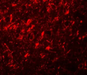 Anti-NALP10 antibody used in IHC (Paraffin sections) (IHC-P). GTX85154
