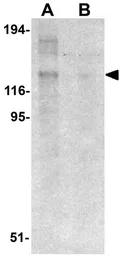 Anti-NALP8 antibody used in Western Blot (WB). GTX85155