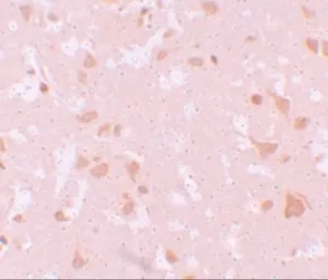 Anti-NLRP7 antibody used in IHC (Paraffin sections) (IHC-P). GTX85156