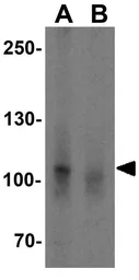 Anti-NLRP7 antibody used in Western Blot (WB). GTX85156