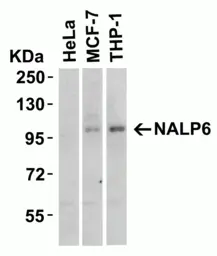 Anti-NALP6 antibody used in Western Blot (WB). GTX85157