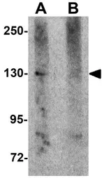 Anti-NALP5 antibody used in Western Blot (WB). GTX85158