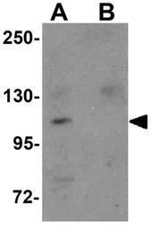 Anti-NALP9 antibody used in Western Blot (WB). GTX85159