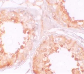 Anti-YBX2 antibody used in IHC (Paraffin sections) (IHC-P). GTX85161
