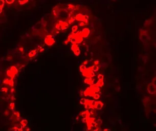 Anti-YBX2 antibody used in IHC (Paraffin sections) (IHC-P). GTX85161