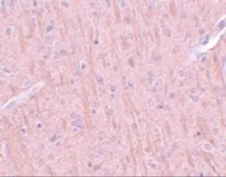 Anti-CCDC106 antibody used in IHC (Paraffin sections) (IHC-P). GTX85167