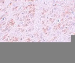 Anti-VENTX antibody used in IHC (Paraffin sections) (IHC-P). GTX85168