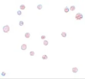 Anti-ATP11A antibody used in Immunocytochemistry/ Immunofluorescence (ICC/IF). GTX85170