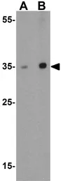 Anti-SCRN3 antibody used in Western Blot (WB). GTX85171