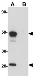 Anti-SCRN1 antibody used in Western Blot (WB). GTX85172