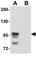 Anti-SCUBE2 antibody used in Western Blot (WB). GTX85173