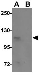 Anti-SCUBE1 antibody used in Western Blot (WB). GTX85174