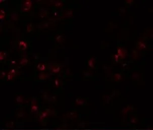 Anti-SCUBE1 antibody used in Immunocytochemistry/ Immunofluorescence (ICC/IF). GTX85174