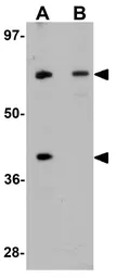 Anti-TCTN3 antibody used in Western Blot (WB). GTX85175