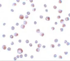 Anti-TCTN3 antibody used in Immunocytochemistry/ Immunofluorescence (ICC/IF). GTX85175