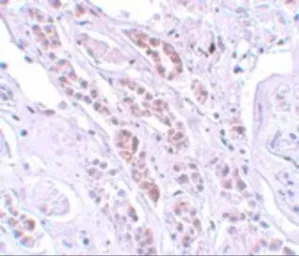 Anti-TCTN1 antibody used in IHC (Paraffin sections) (IHC-P). GTX85178
