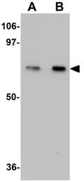 Anti-TCTN1 antibody used in Western Blot (WB). GTX85178