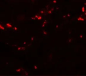 Anti-TCTN1 antibody used in IHC (Paraffin sections) (IHC-P). GTX85178