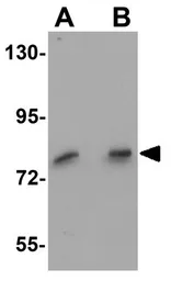 Anti-FREM1 antibody used in Western Blot (WB). GTX85179
