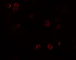 Anti-FREM1 antibody used in Immunocytochemistry/ Immunofluorescence (ICC/IF). GTX85179