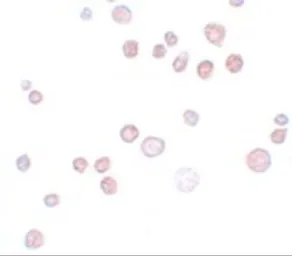 Anti-FREM1 antibody used in Immunocytochemistry/ Immunofluorescence (ICC/IF). GTX85179