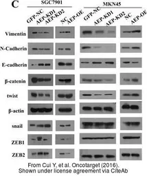 Anti-ZEB2 antibody used in Western Blot (WB). GTX85180