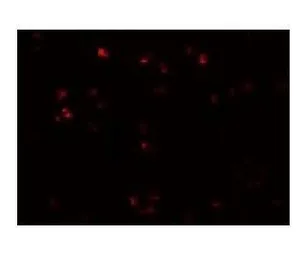 Anti-ZEB2 antibody used in Immunocytochemistry/ Immunofluorescence (ICC/IF). GTX85180