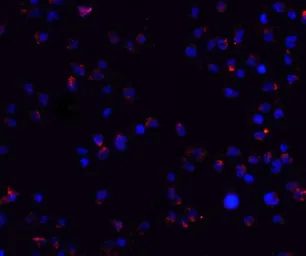 Anti-ZEB2 antibody used in Immunocytochemistry/ Immunofluorescence (ICC/IF). GTX85180