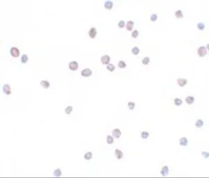 Anti-ZEB2 antibody used in Immunocytochemistry/ Immunofluorescence (ICC/IF). GTX85180