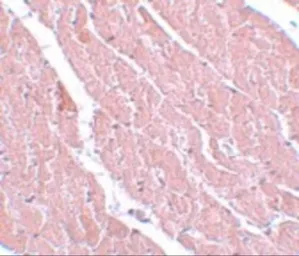 Anti-ATG13 antibody used in IHC (Paraffin sections) (IHC-P). GTX85183