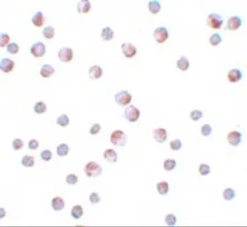 Anti-ATG9B antibody used in Immunocytochemistry/ Immunofluorescence (ICC/IF). GTX85184