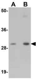 Anti-NSE2 antibody used in Western Blot (WB). GTX85185