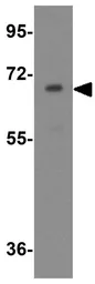Anti-APC7 antibody used in Western Blot (WB). GTX85187