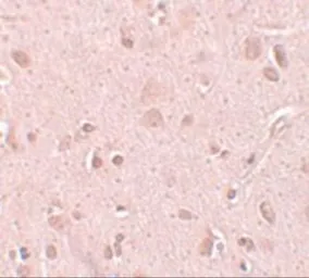 Anti-TINP1 antibody used in IHC (Paraffin sections) (IHC-P). GTX85188