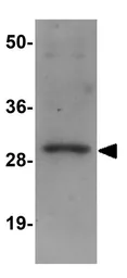 Anti-TINP1 antibody used in Western Blot (WB). GTX85188