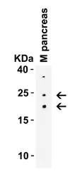 Anti-CCDC69 antibody used in Western Blot (WB). GTX85190