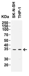 Anti-CCDC69 antibody used in Western Blot (WB). GTX85190