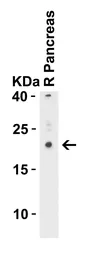 Anti-CCDC69 antibody used in Western Blot (WB). GTX85190