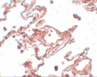 Anti-CCDC69 antibody used in IHC (Paraffin sections) (IHC-P). GTX85190